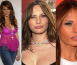 Melania Trump o operacjach plastycznych: 